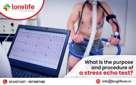 stress echocardiogram results|Stress Echocardiography: Purpose, Procedure, and Results.